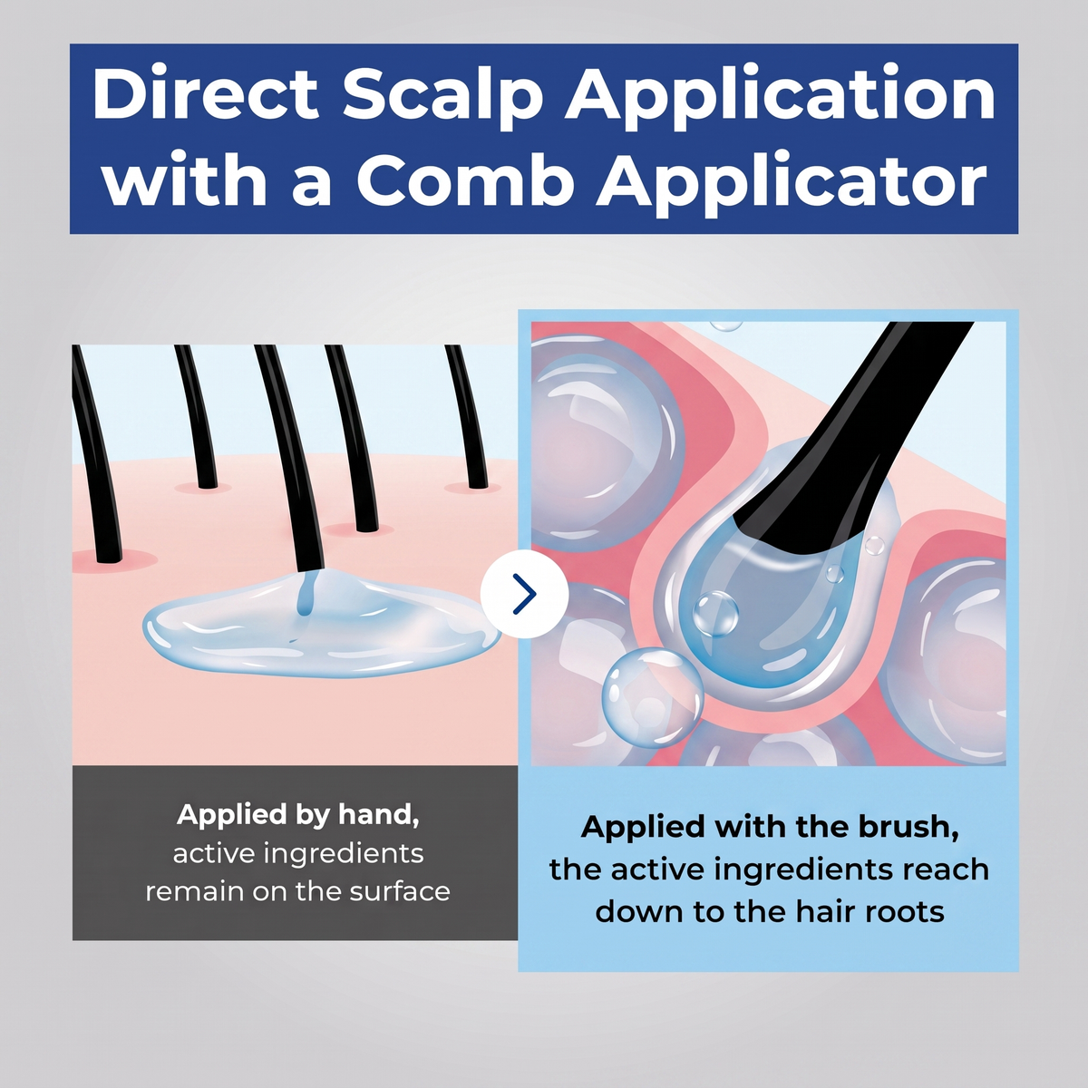 Epais™ Scalp Boosting Ampoule
